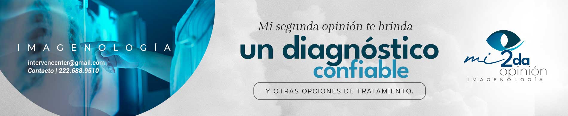 Mi Segunda Opinión