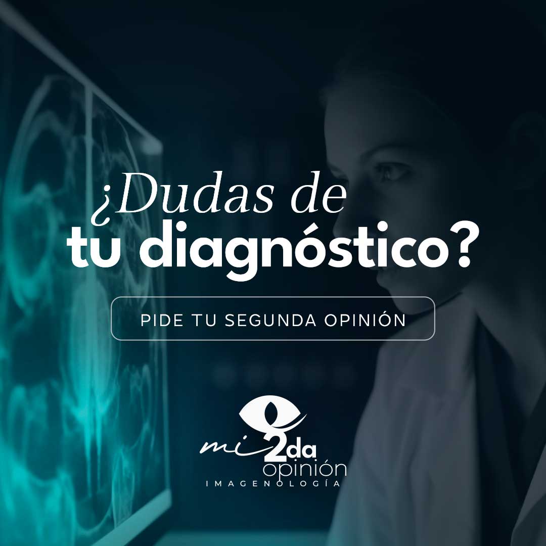 Segunda Opinión